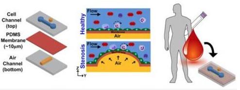在芯片上實現(xiàn)動脈粥樣硬化的模擬，并在心臟病發(fā)作前評估血管的狹窄和血液的健康狀況