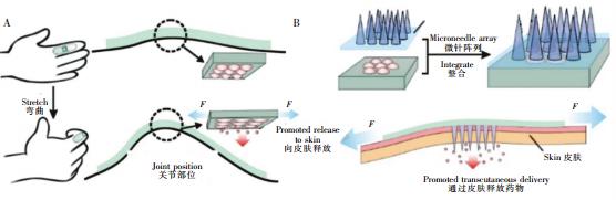 圖2可穿戴式微流控藥物釋放裝置。(A)內(nèi)置藥物的可穿戴式微流控芯片,通過(guò)手指的彎曲完成藥物釋放(B)內(nèi)置藥物的可穿戴芯片與微針陣列結(jié)合