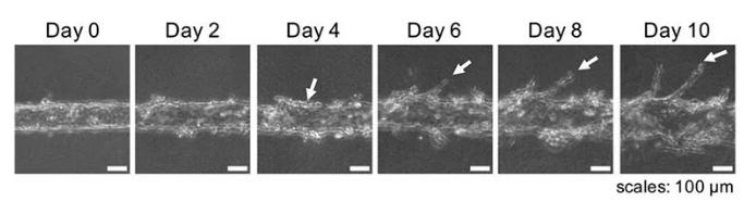 隨著時間的推移，可以用顯微鏡觀察到血管的新生。圖片來源：EBioMedicine