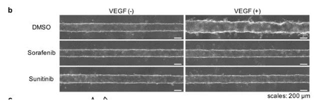 向芯片中添加抗腫瘤藥物sorafenib或sunitinib，觀察到了血管新生的抑制現(xiàn)象。 圖片來源：EBioMedicine
