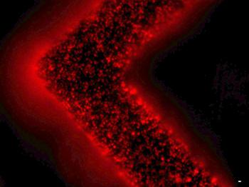 細(xì)胞外囊泡（紅色）從患者腫瘤細(xì)胞中釋放并被捕獲在EV-HB芯片表面。