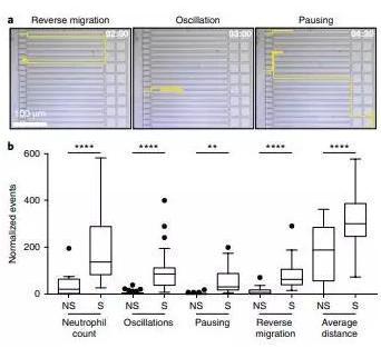 敗血癥特異性的中性粒細胞自發(fā)的遷移模式。