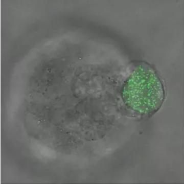 華中科大研發(fā)出測量三維生物力的新技術(shù)，有望用于癌癥早期診斷