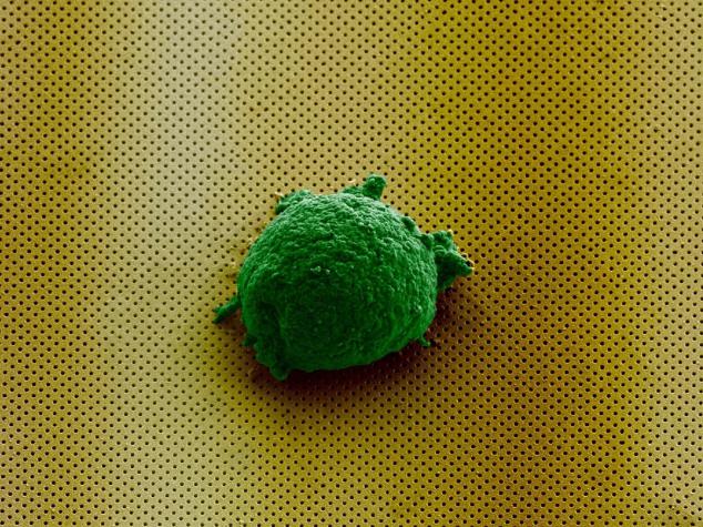 《Small》雜志封面圖片顯示，單個淋巴瘤細胞孤獨地存在于新型生物傳感器上。