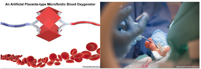 微加工技術(shù)解決早產(chǎn)兒肺功能不全的問題不再是夢
