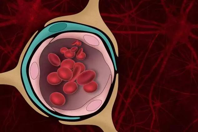 組織模型揭示血腦屏障在阿爾茨海默病中的作用 組織模型揭示血腦屏障在阿爾茨海默病中的作用