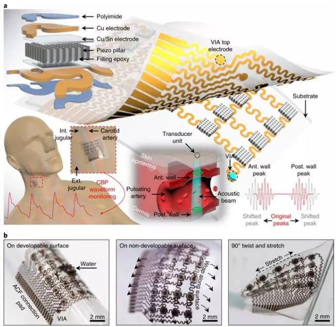 可實(shí)時(shí)監(jiān)測(cè)體內(nèi)深處動(dòng)脈血壓的柔性超聲波貼片