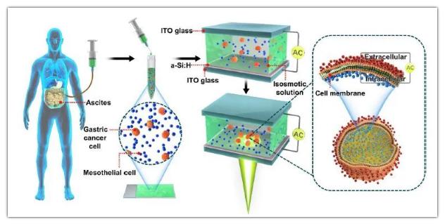 OEK微流控芯片用于檢測(cè)腹膜轉(zhuǎn)移和細(xì)胞膜電容 OEK微流控芯片用于檢測(cè)腹膜轉(zhuǎn)移和細(xì)胞膜電容